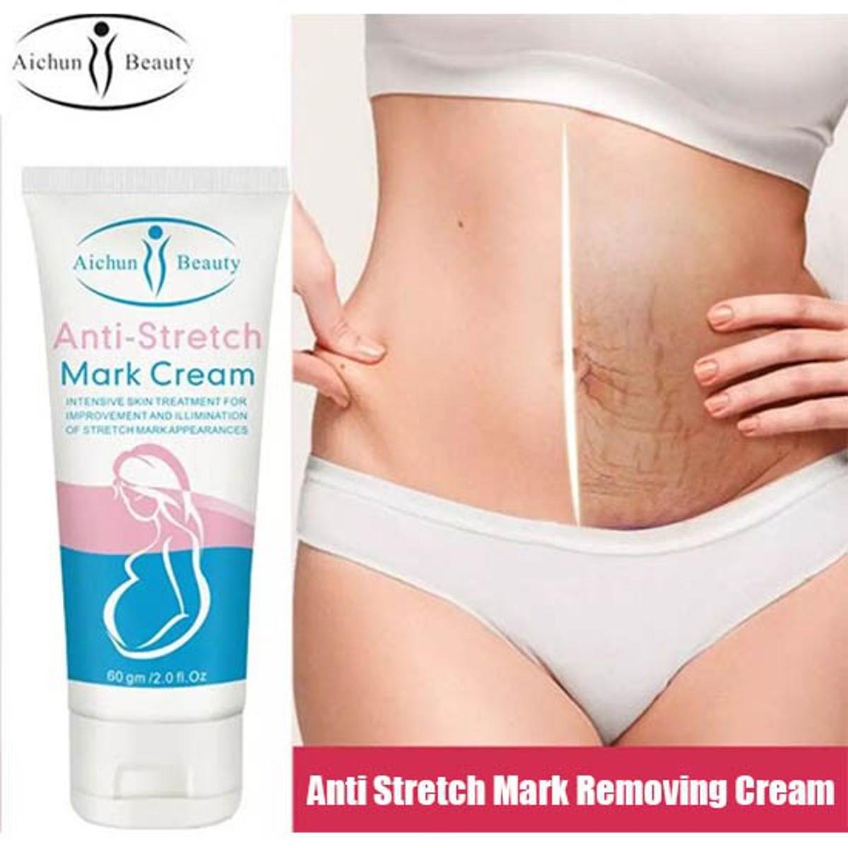 Anti-Stretch Mark Cream Remove Stretch Marks Moisturizing Nourishing Remove Cellulite Improve Rough Brighten Skin Tone Skin Care