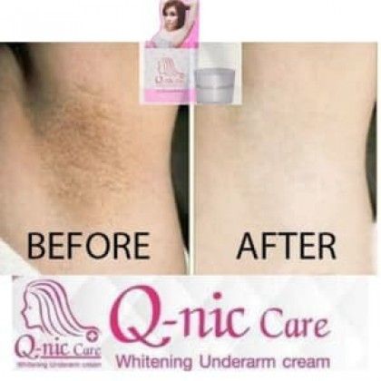 Q-Nic Care Underarm Whitening Clear Cream Smooth skin Legs Knee Neck Armpit 1x